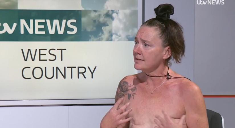 „Betonkemény volt a bőröm” – Felső nélkül futja a maratonokat a mellráktúlélő anya