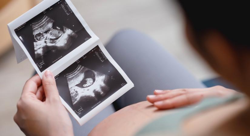 Egészséghoroszkóp: A Bak váratlan gyermekáldásra, az Ikrek fogfájásra számíthat, a Rákra csodás gyógyulás vár