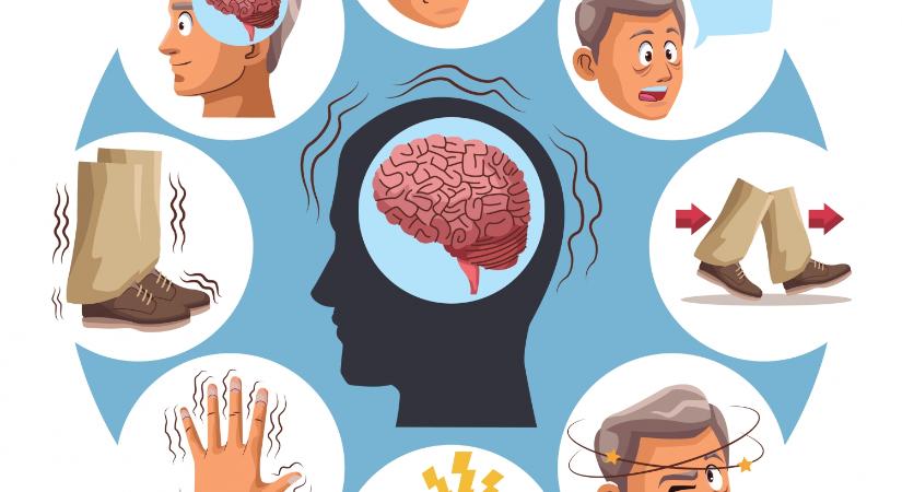 Döntéstámogató eszköz Parkinson-kórban