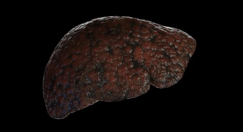 Tömegek használják ezt a fűszert, most kiderült, hogy károsíthatja a májat