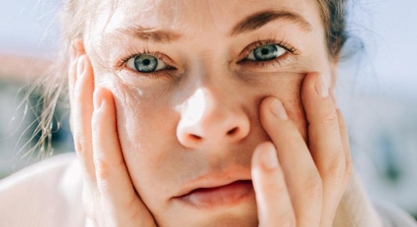 A bőrünkön is nyomot hagy a stressz – ezek a figyelmeztető jelek