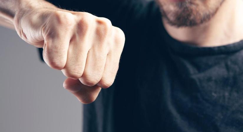 Brutális utcai támadás Szekszárdon: „Megöllek!” – kiabálta, majd kiverte áldozata fogát