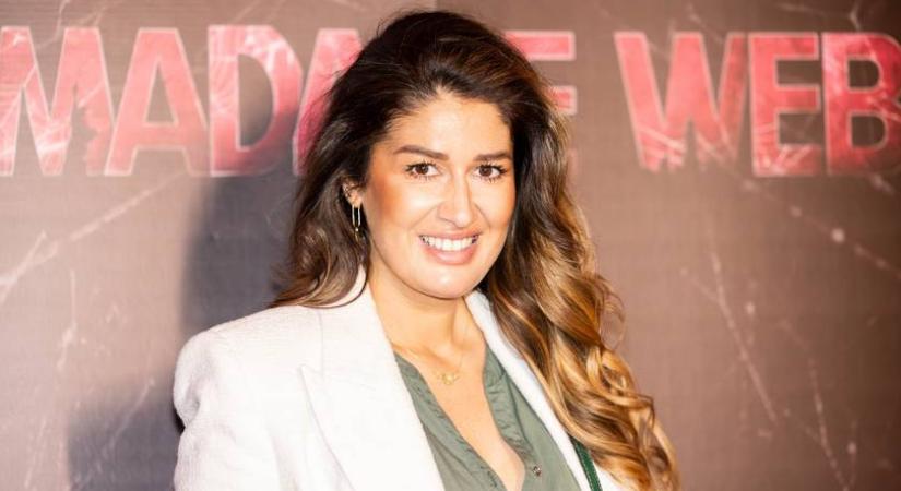 A magyar énekesnő vállalta plasztikai beavatkozását: előtte-utána fotón az eredmény