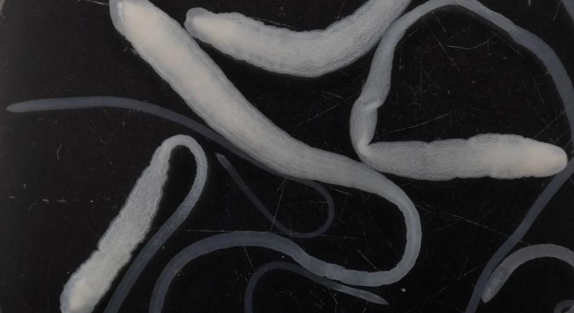 9 méteres szörnyeteg is lakhat a hasadban: ez a galandférgesség 5 leggyakoribb figyelmeztető jele