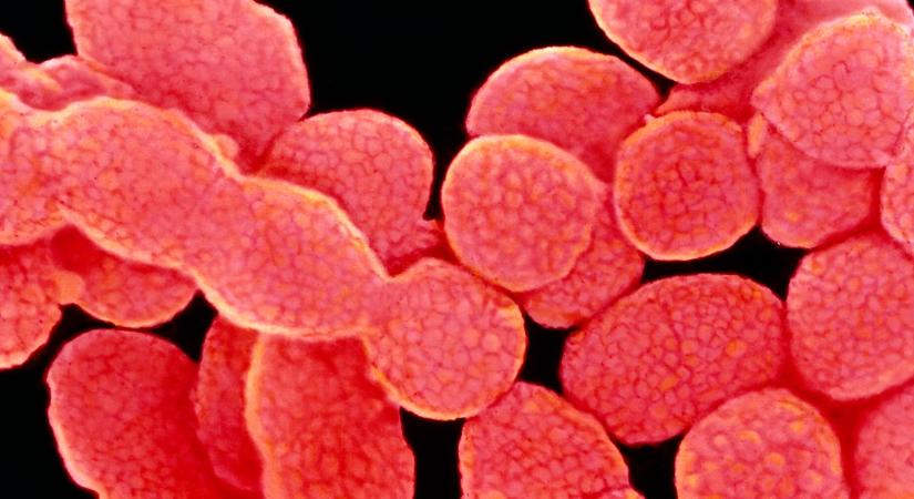 Húsevő baktériumok falták fel egy férfi karját és lábát, mindössze három nap alatt