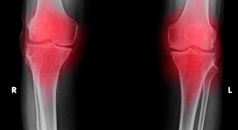 Vége a fájdalomnak: megoldást találhattak a magyarok tömegeit érintő betegségre