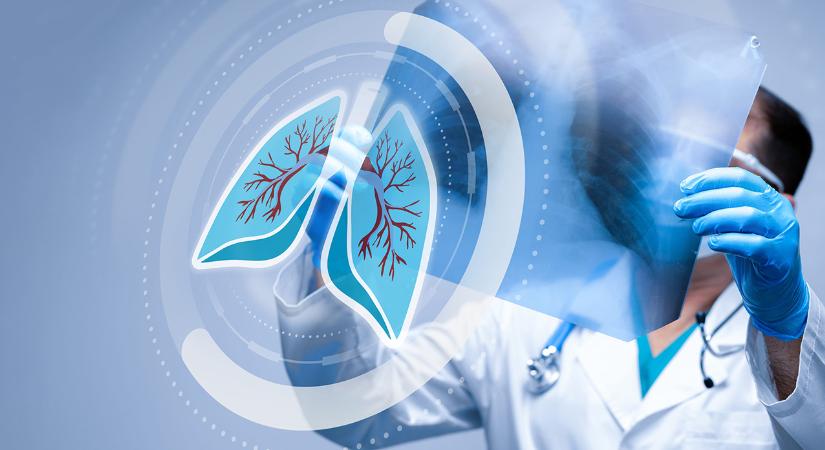 Komplex tüdőegészség-program