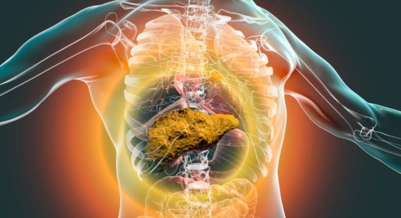 Lett ilyen bőrelváltozásod? Előrehaladott májzsugorodásra utalhat