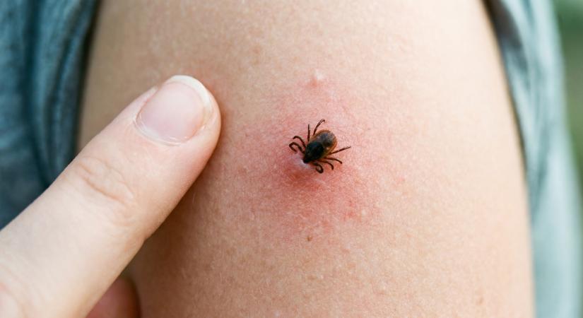 Az erdészek felfedték a kullancsok elleni védekezés módszerét - Egyetlen tárgy elég