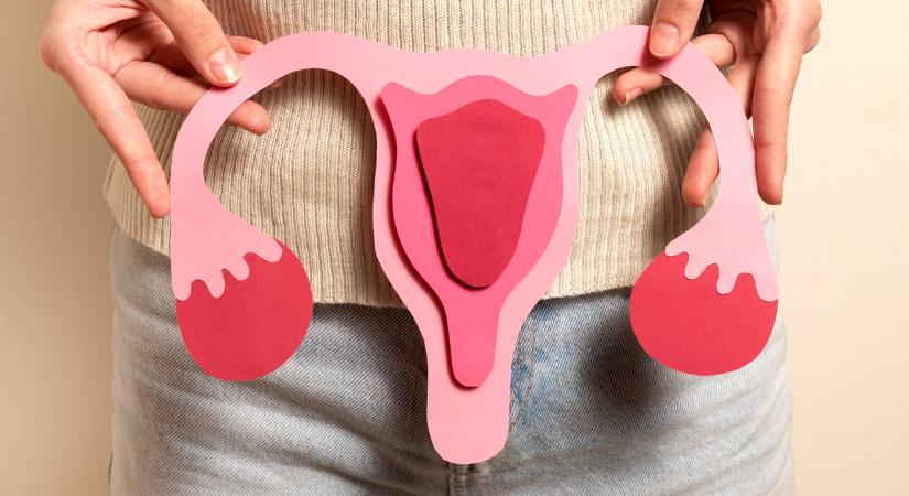 PCOS és mozgásszervi fájdalom – van köze egymáshoz?