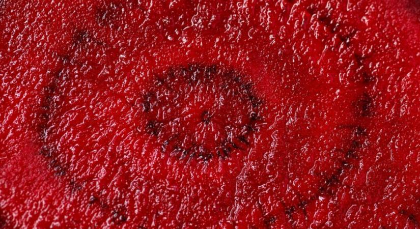 Vigyázz! A cékla komolyan megbetegíthet!