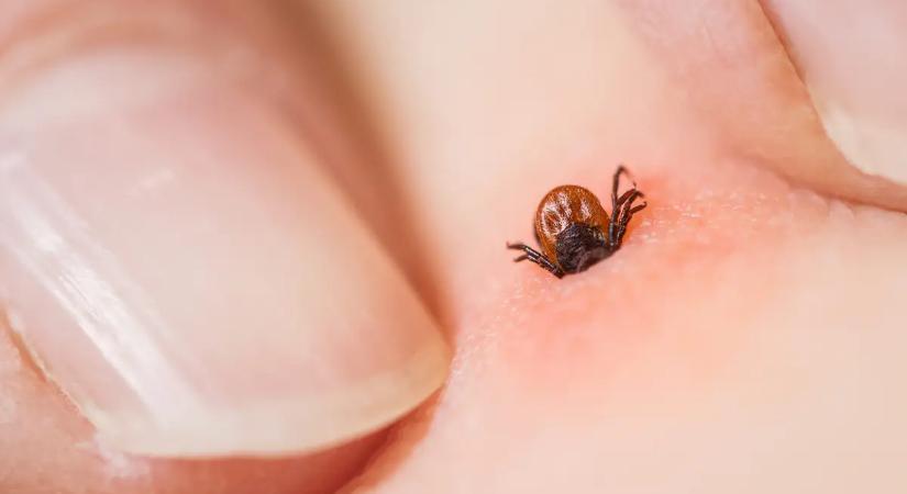 Ezzel a hibával mágnesként vonzod a kullancsokat a kertedbe