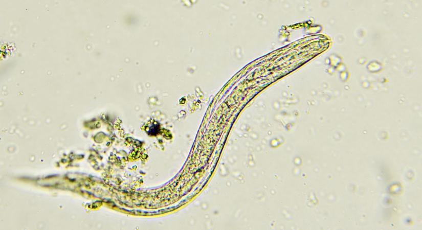 Családon belül gyorsan terjed: így lehet megszabadulni a bélféregtől