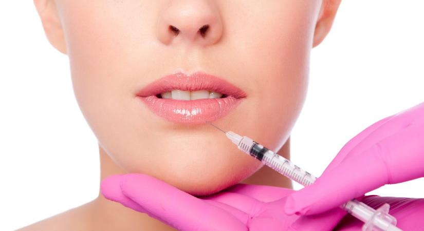 Illegális ajakfeltöltés: ekkora büntetést kapott a békéscsabai kuruzsló - nem ez az első eset