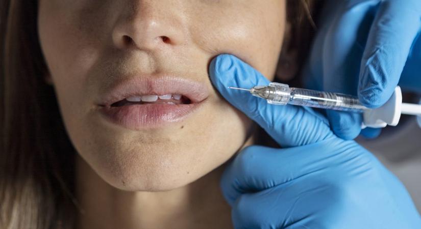 Képesítés nélkül végzett hialuronsavas ajakfeltöltéseket egy fiatal békéscsabai kozmetikus