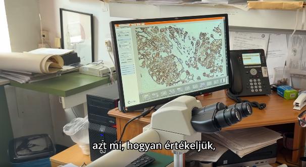 Gyorsabb eredmények, pontosabb diagnózis a patológián: csúcstechnológia a Markhot Ferenc Oktatókórházban - videó