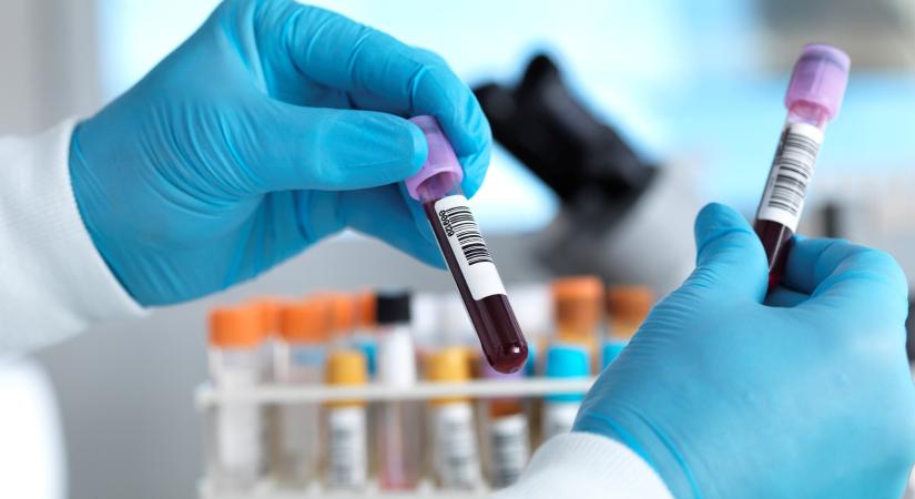 Ez a legritkább vércsoport a világon – Nem véletlenül hívják aranyvérnek