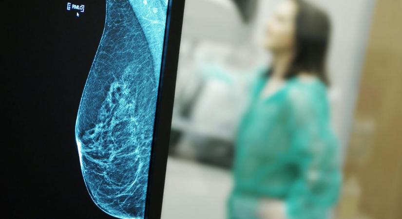 Megcsinálták a női mell legrészletesebb térképét, fény derült az mellrák titkára