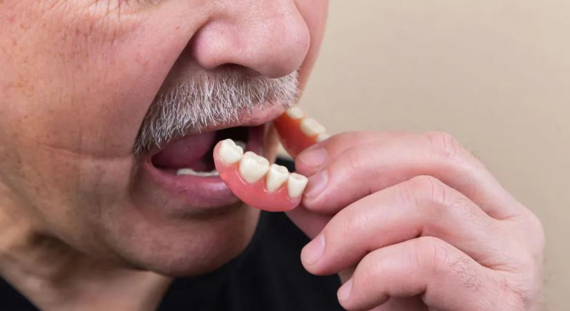 Megdöbbentő, hány ember marad fogak nélkül Magyarországon