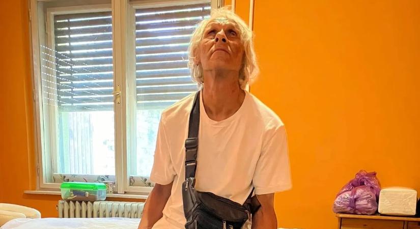„Eltűnt a fél arcom” - súlyos balesetet szenvedett József, a vak masszőr - Fotó
