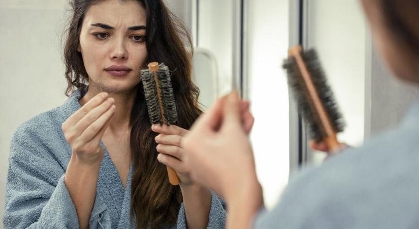 Életmód, hormonok, környezet vagy genetika – Honnan tudhatom, mitől hullik a hajam?