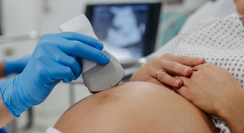 Szülészorvos-választás: megoldás vagy zsákutca? – Édesanyák meséltek őszintén tapasztalataikról