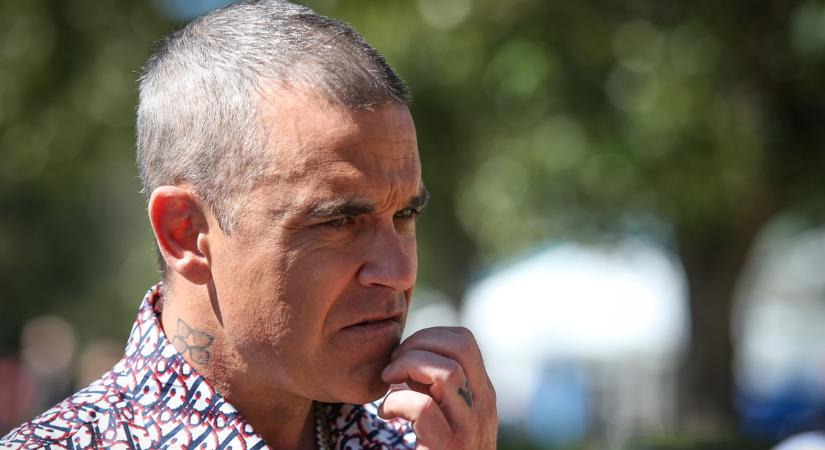 Őrületes balesetet szenvedett Robbie Williams: egy fogától el kellett búcsúznia