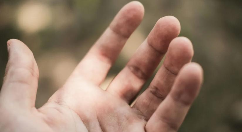 Felrobbant a net az UV-fényes videó miatt: rémisztő, mi rejtőzik a tenyerünkön