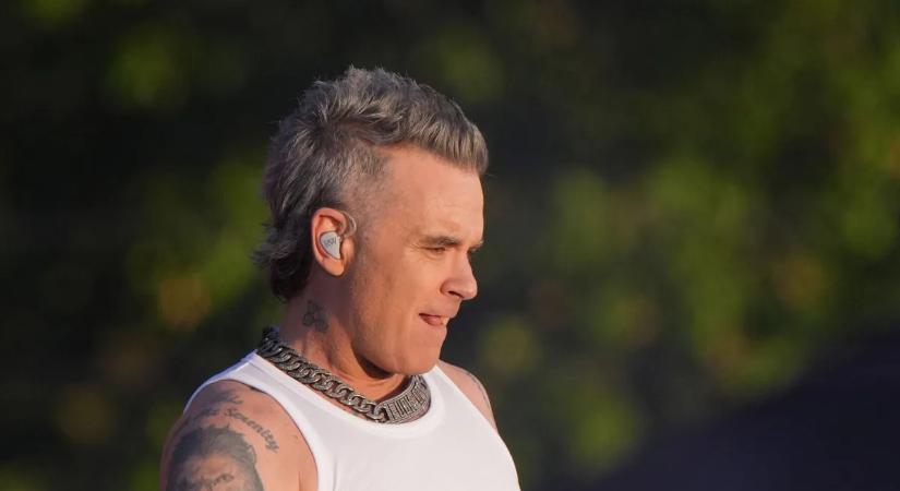 Baleset érte Robbie Williams-t, kihullott a foga - FOTÓ!