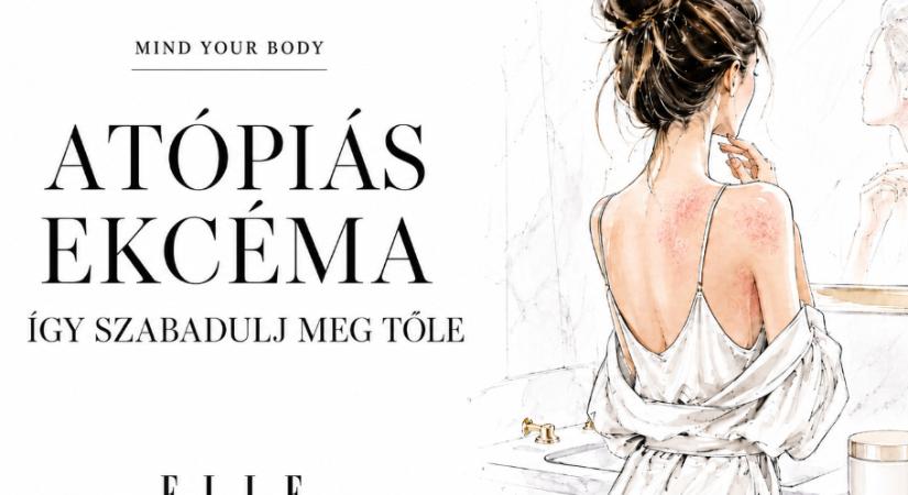 Mit érdemes tudni az atópiás ekcémáról? – megtudhatod az új MIND YOUR BODY Podcast adásából