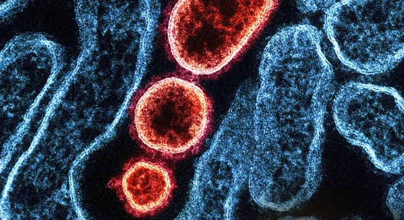 Biológus a hantavírusról: hazánkban kétféle típus terjed