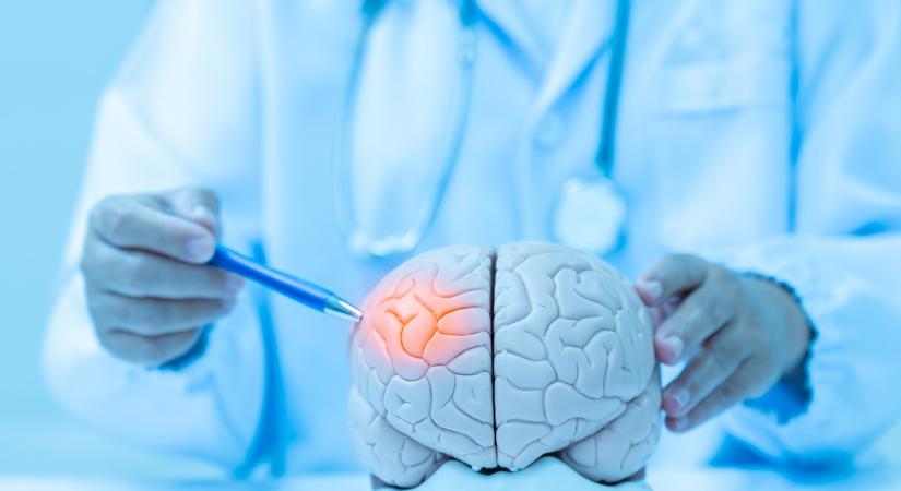 Ez a fajta pulzusszám stroke-hoz vezethet – Nyugtalanító jelenséget fedeztek fel a tudósok