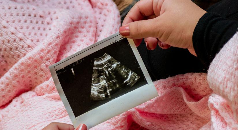 Azt hitte, csak másnapos: valójában már öt hónapos terhes volt a fiatal nő