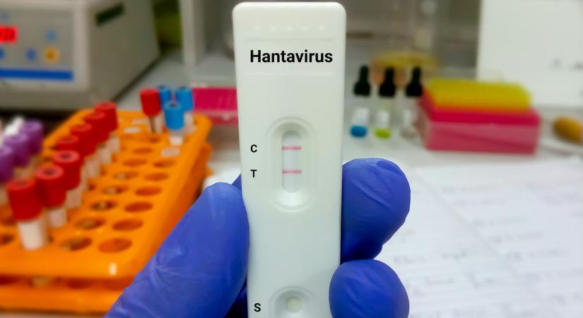 Magas lázzal és izomfájdalommal indulhat a hantavírus-fertőzés – ezt kell tudni róla