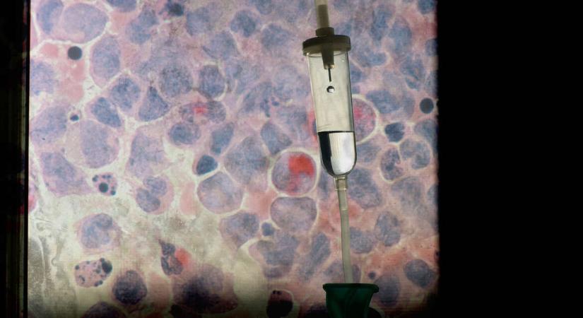 A forradalmi rákgyógyszer a HIV kezelésében is áttörést hozhat