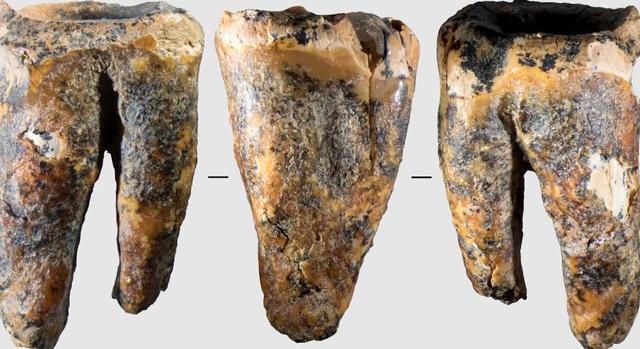 Már a neandervölgyi fogorvosok is használtak fúrót