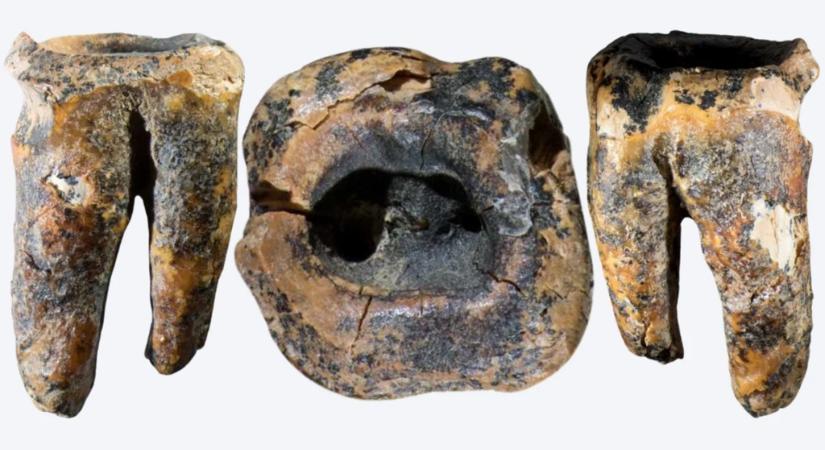 60 ezer éves neandervölgyi fogorvos nyomaira bukkantak