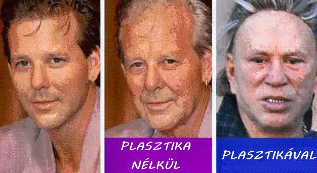 Így néznének ki a sztárok, ha nem a plasztika, hanem a természetes öregedés mellett döntenének