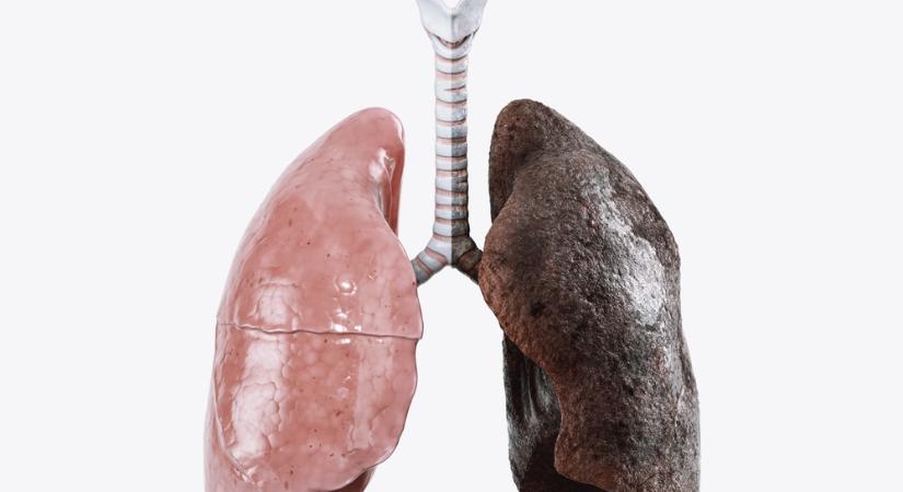 Tényleg regenerálódik a tüdő, ha letesszük a cigarettát?