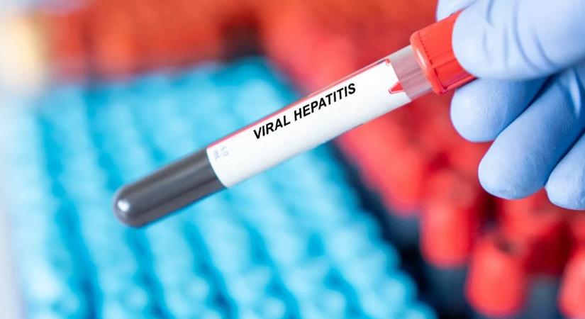 Hepatitis járvány tört ki ebben a magyar vármegyében, ezt kérik a lakosságtól