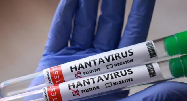 Mit kell tenni hantavírusfertőzés gyanúja esetén – mik az első tünetek és mikor kell sürgősen mentőt hívni?