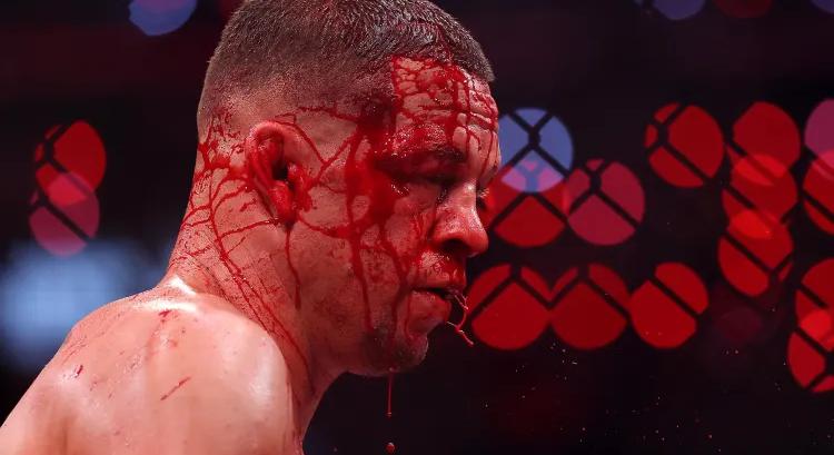 Stitch Duran a Hellraiser-szereplővé vert Nate Diazról: 20 öltést és 15 kapcsot kapott