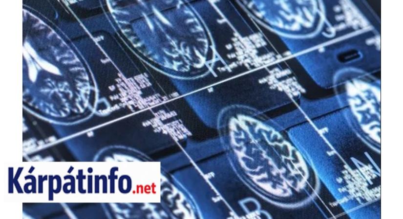 Megtalálták az ételt, ami véd az Alzheimer-kór ellen