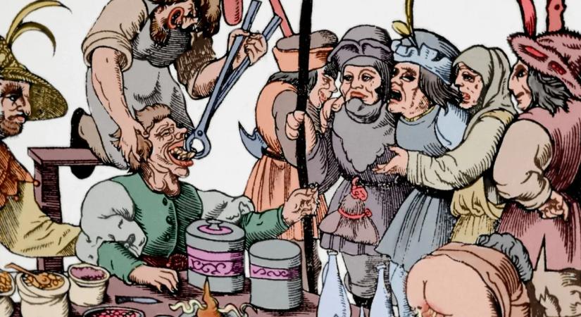 Élet vagy halál? 6 középkori orvosi módszer, ami garantáltan a sírba vitt