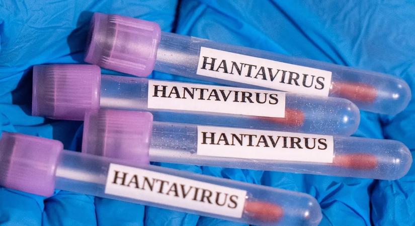 Ez a hantavírus 5 legfontosabb tünete: így ismered fel, ha valaki megfertőződött a munkahelyeden