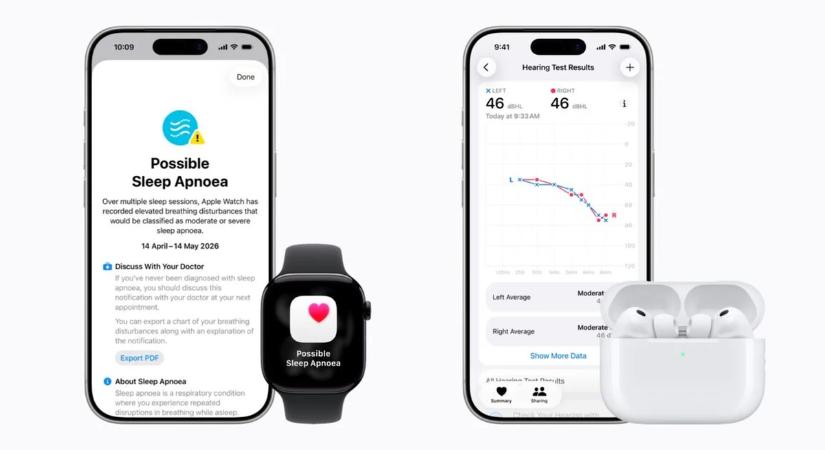 Elképesztő egészségügyi fegyvert kaptak az Apple-tulajdonosok