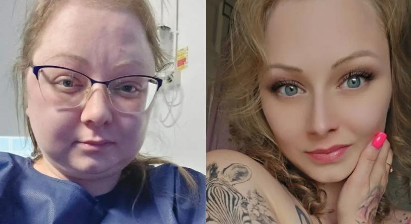 Ritka kór tette tönkre a magyar modell életét – 56 kilót hízott, kihullott a haja