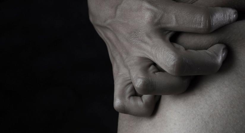 Anyja halála után kontrollálhatatlan bőrkaparásba menekült a nő – a betegség örökre megváltoztatta az életét