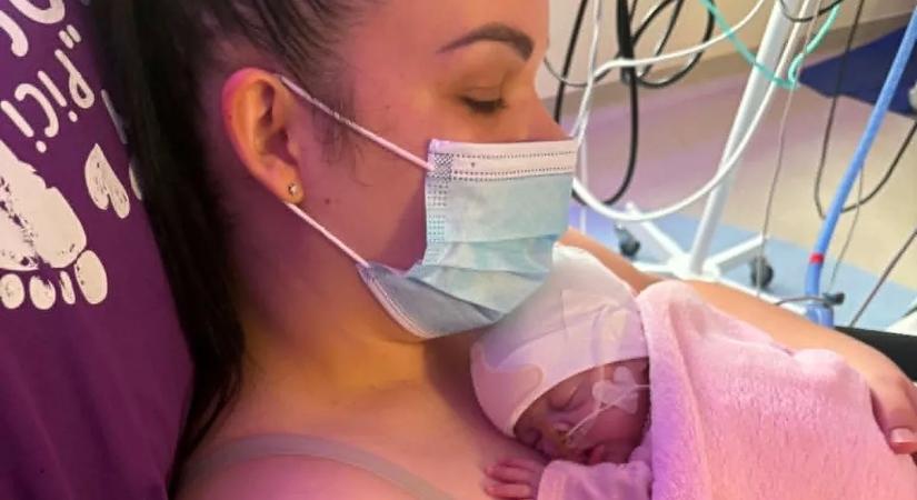 “Ezt nem kívánom senkinek, hogy átélje” - Eszterék kislánya extrém koraszülöttként jött a világra