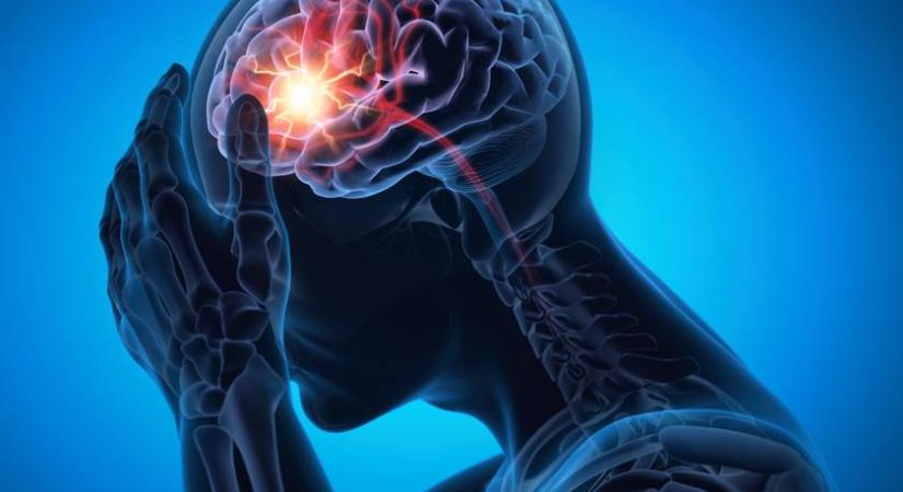 Így védekeznek az agysejtek a stroke okozta pusztulás ellen: meglepő módon fognak össze